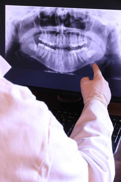 Best Emergency Wisdom Teeth Removal in Blue Earth, MN